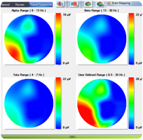 EEG brain mapping visualization