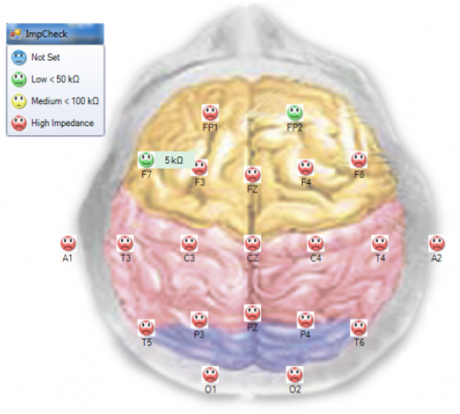 Quantitative EEG topographic analysis