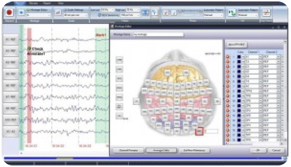 EEG Portable 3840 reporting workspace