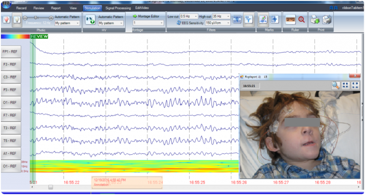 EEG Portable 3840 synchronized EEG and video software