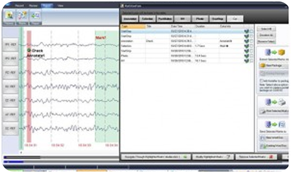 NR Sign EEG software event review interface
