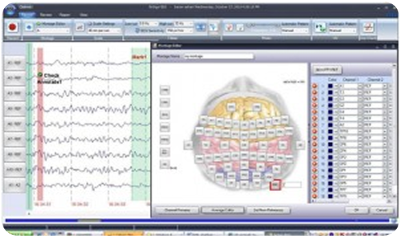 NR Sign EEG software montage and waveform interface