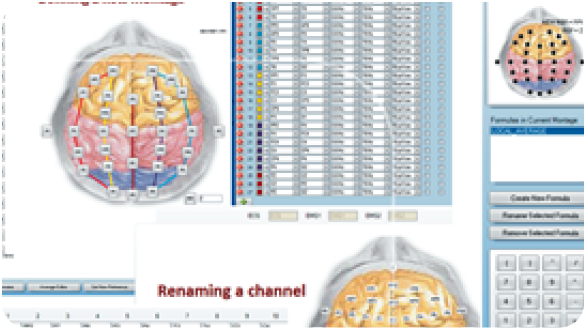 EEG 5000Q neurodiagnostic analysis interface