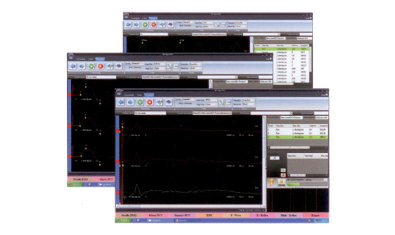Professional EMG reporting and examination history screens
