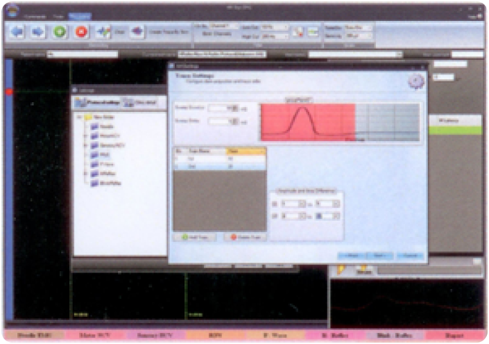 EMG signal processing and latency measurement interface
