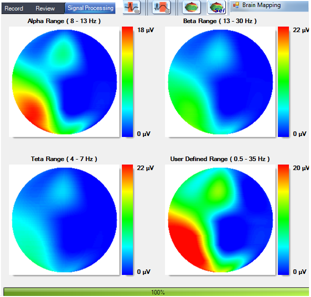 Brain mapping
