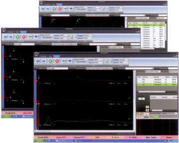 EMG software interface view 3