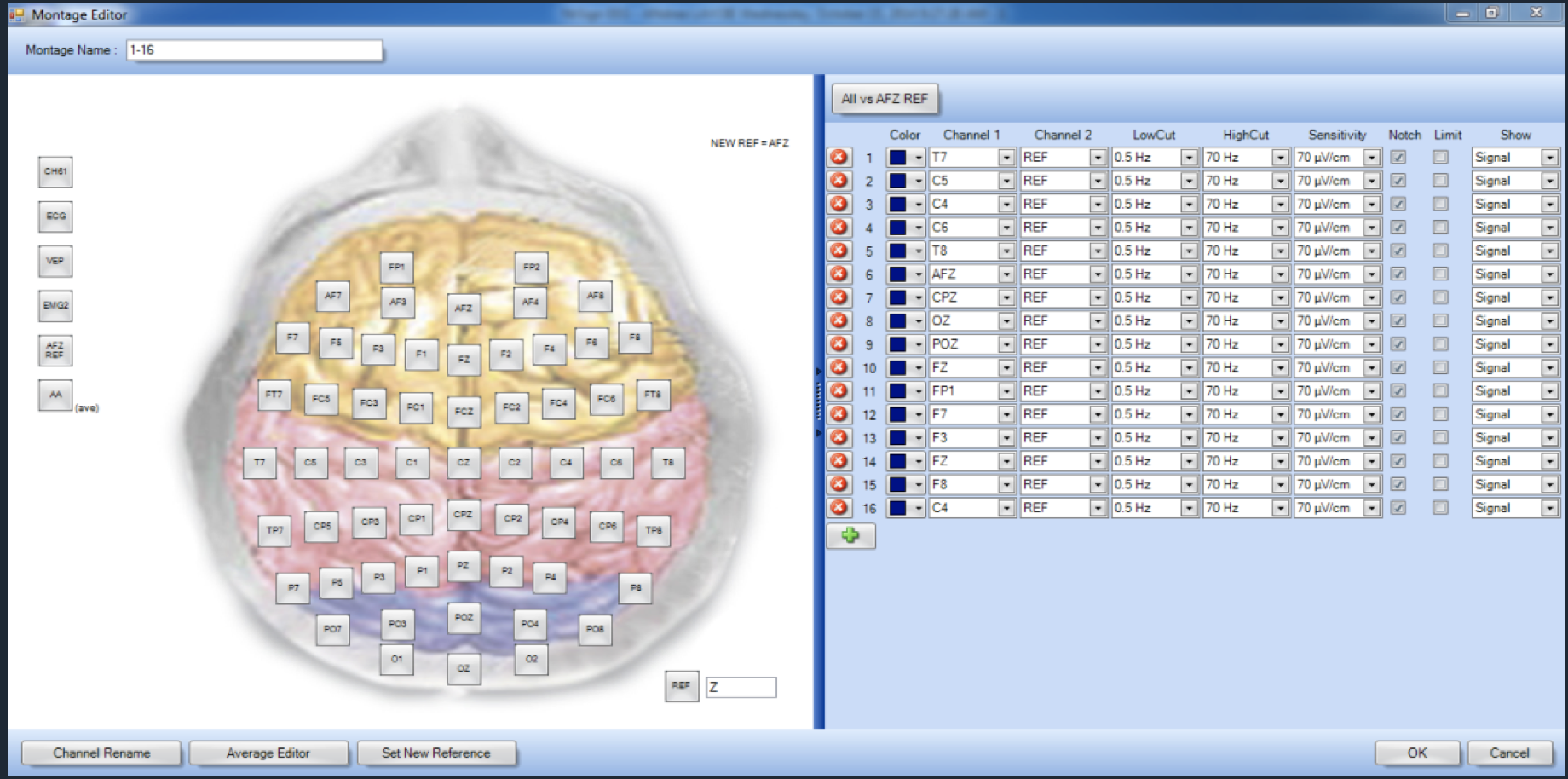 Eeg Linux EEG Software Features – NR Sign Inc.